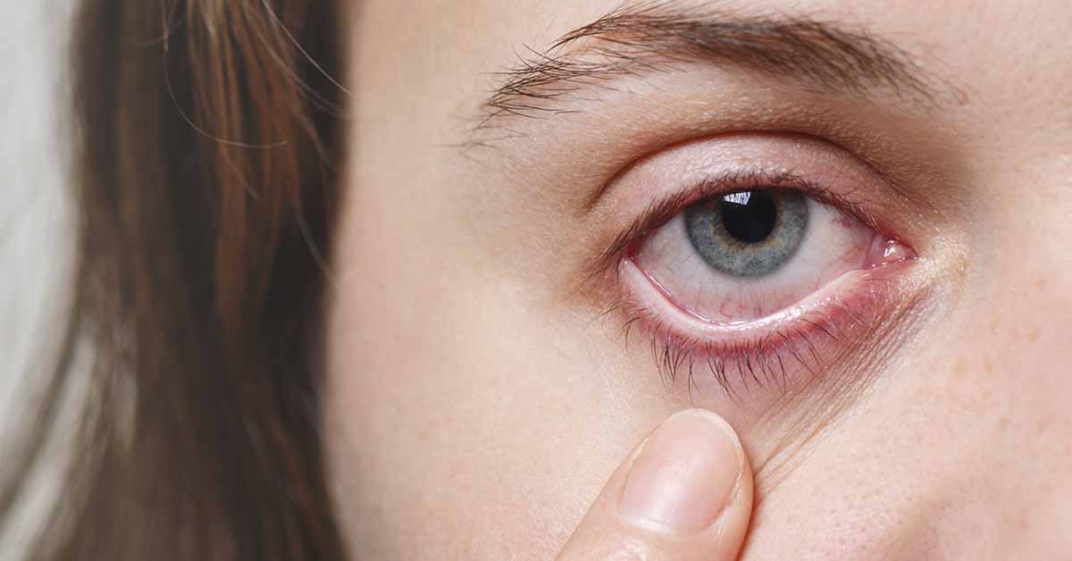 Descolamento de retina: sintomas de emergência e tratamento